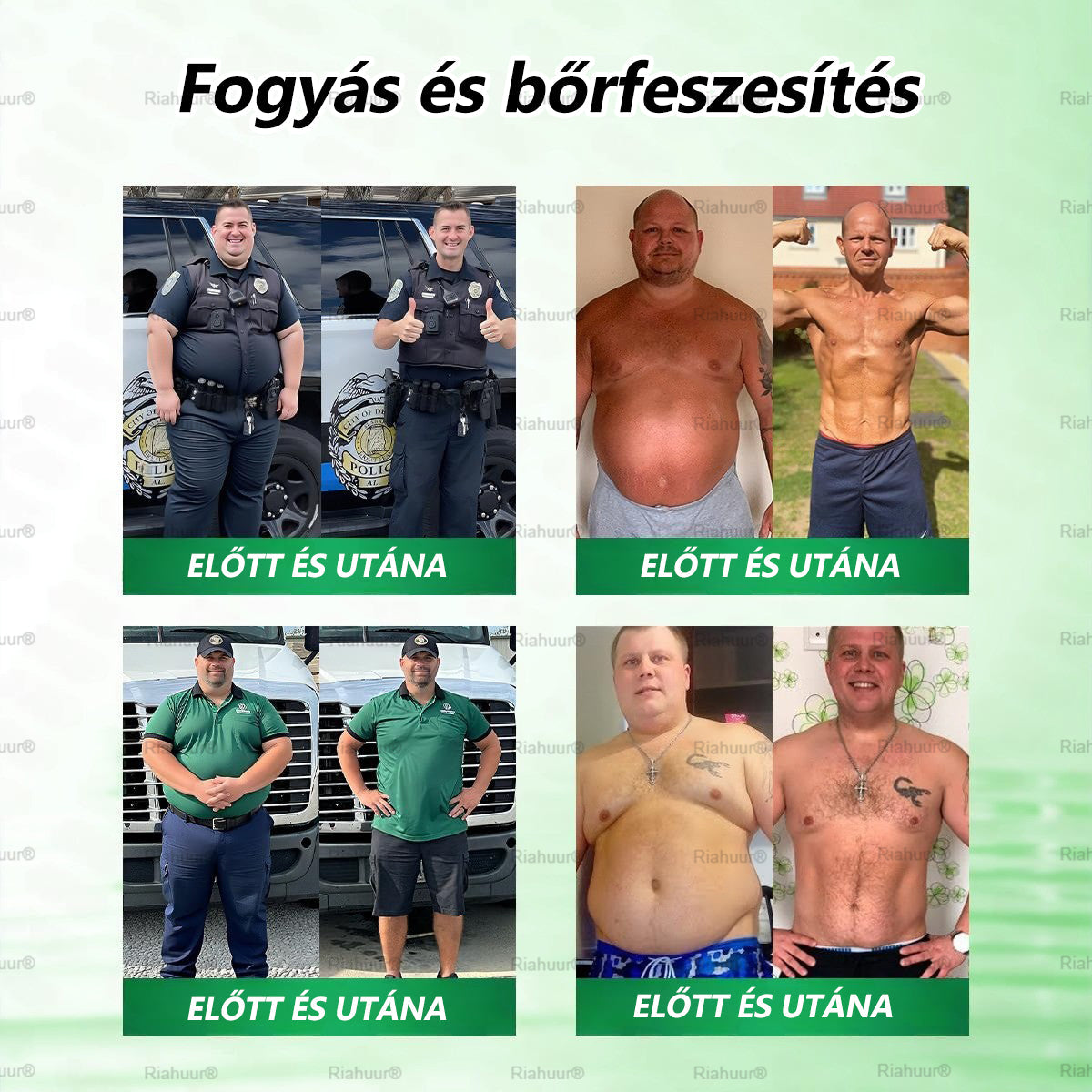 Genayu® Moringa × Berberin × AMPK – 8 előny Karcsúsító & Metabolikus Nano Mikrotűs Tapasz 🇭🇺 (Naponta csak egyszer, látható változások már 7 nap alatt) ✅ Elhízás, megereszkedett bőr, cukorbetegség, alvási apnoe, ízületi problémák és még sok más esetén