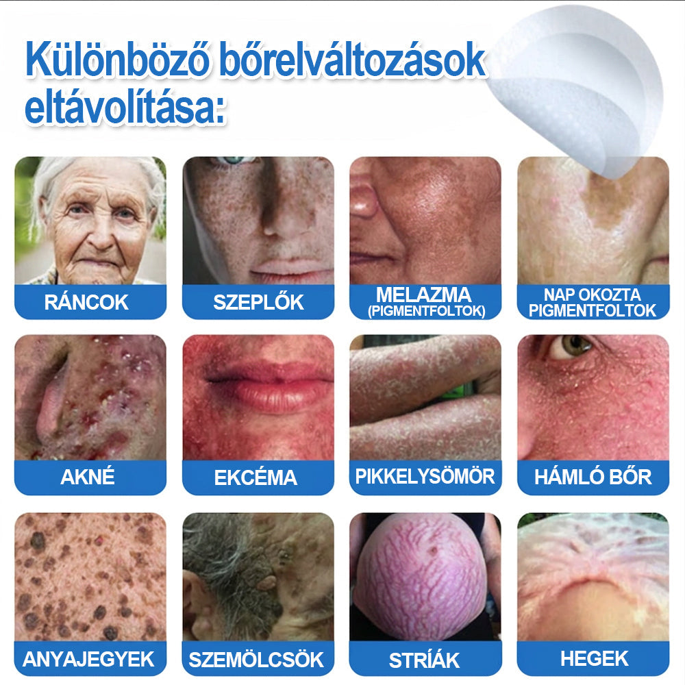 Már csak 7 csomag maradt! Szerezze meg a HISKIN® tapaszt 80% kedvezménnyel! Búcsút mondhat a kellemetlen szemölcsöknek és bőrkinövéseknek 1–4 hét alatt. Villámakció + 180 napos pénzvisszafizetési garancia. Siessen!