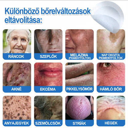 Már csak 7 csomag maradt! Szerezze meg a HISKIN® tapaszt 80% kedvezménnyel! Búcsút mondhat a kellemetlen szemölcsöknek és bőrkinövéseknek 1–4 hét alatt. Villámakció + 180 napos pénzvisszafizetési garancia. Siessen!