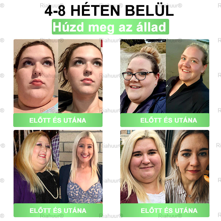 Genayu® Moringa × Berberin × AMPK – 8 előny Karcsúsító & Metabolikus Nano Mikrotűs Tapasz 🇭🇺 (Naponta csak egyszer, látható változások már 7 nap alatt) ✅ Elhízás, megereszkedett bőr, cukorbetegség, alvási apnoe, ízületi problémák és még sok más esetén