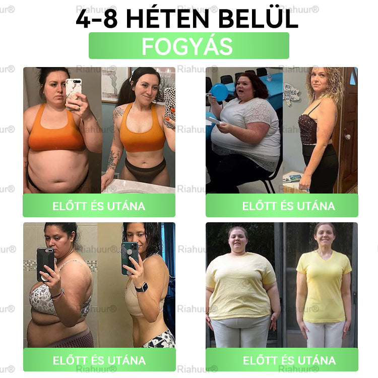 Genayu® Moringa × Berberin × AMPK – 8 előny Karcsúsító & Metabolikus Nano Mikrotűs Tapasz 🇭🇺 (Naponta csak egyszer, látható változások már 7 nap alatt) ✅ Elhízás, megereszkedett bőr, cukorbetegség, alvási apnoe, ízületi problémák és még sok más esetén